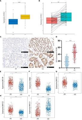 The clinical significance of mitochondrial calcium uniporter in gastric cancer patients and its preliminary exploration of the impact on mitochondrial function and metabolism